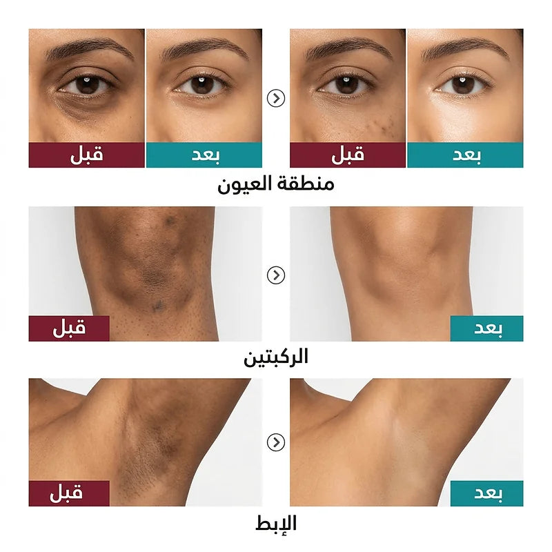 كريمة تفتيح و تبييض البشرة